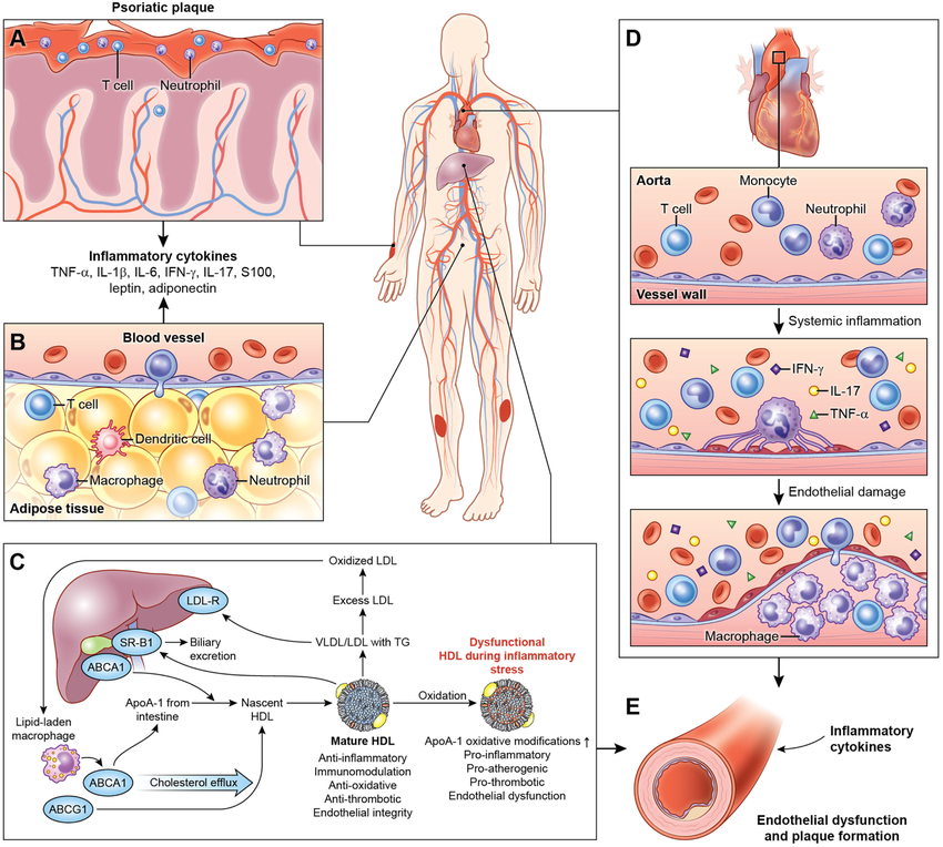 Managing chronic inflammation with psoriasis