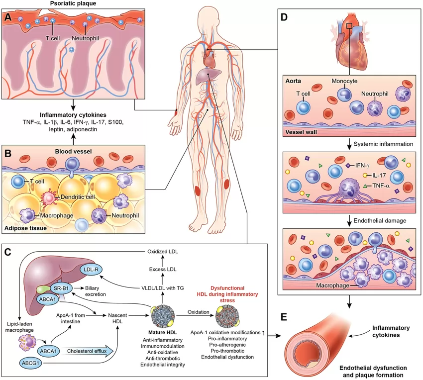 Managing chronic inflammation with psoriasis