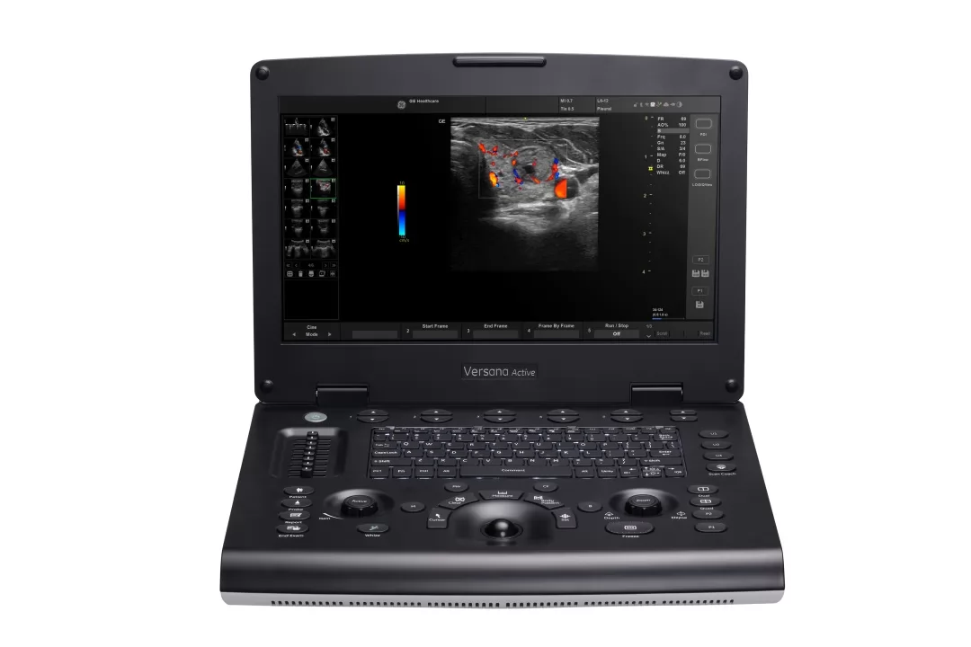 GE Versana Active Plus