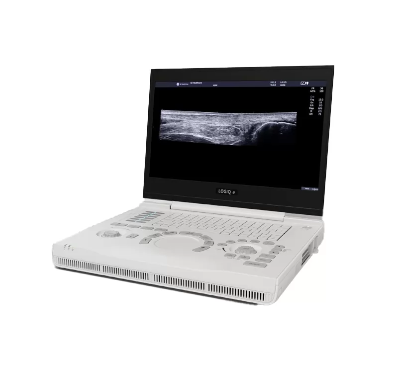 GE LOGIQ e R9